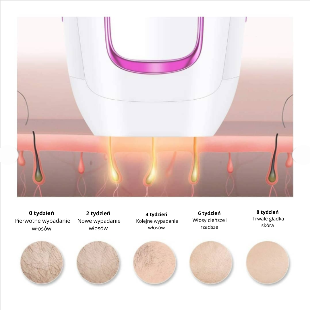 IPL Laser do Depilacji, SKU:7012